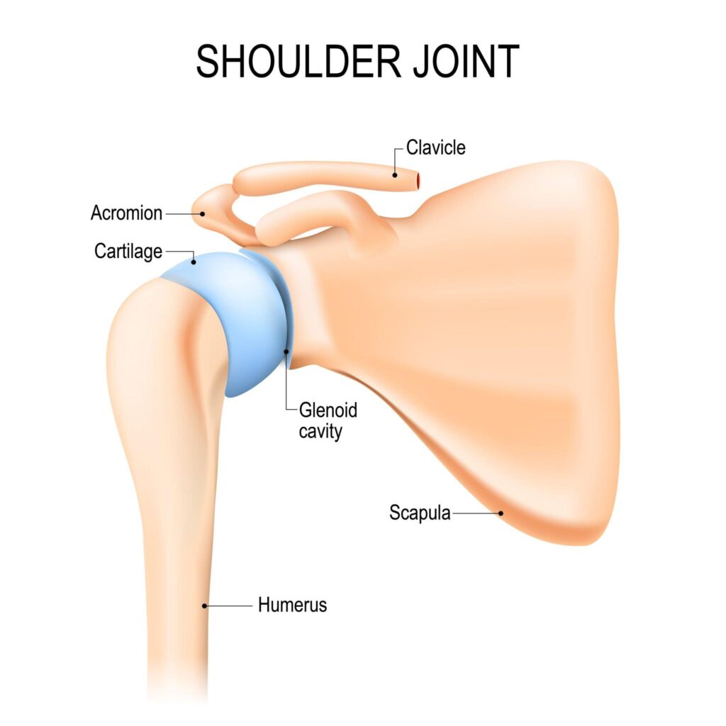 Shoulder Revision